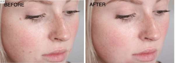 Banuba video face beautification acne removal