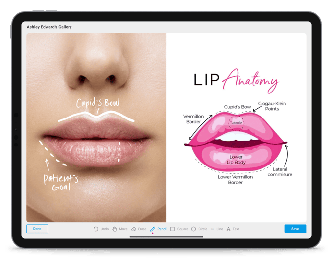 touchmd plastic surgery app