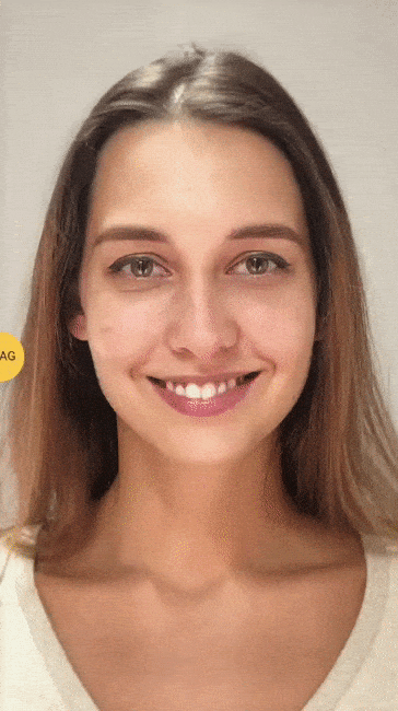 eye bag removal