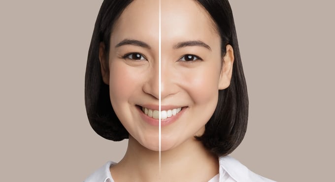 ar teeth whitening