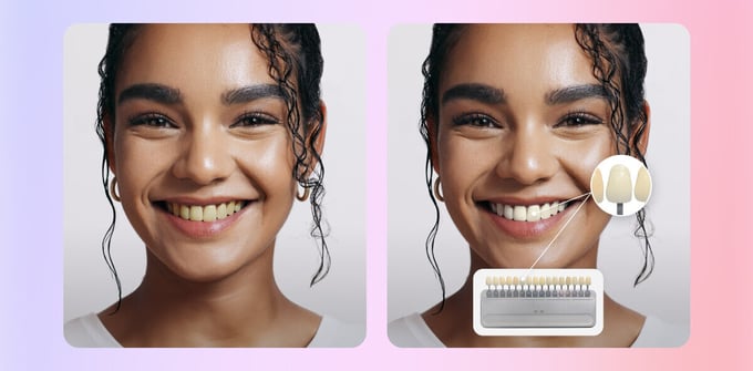 ar teeth whitening